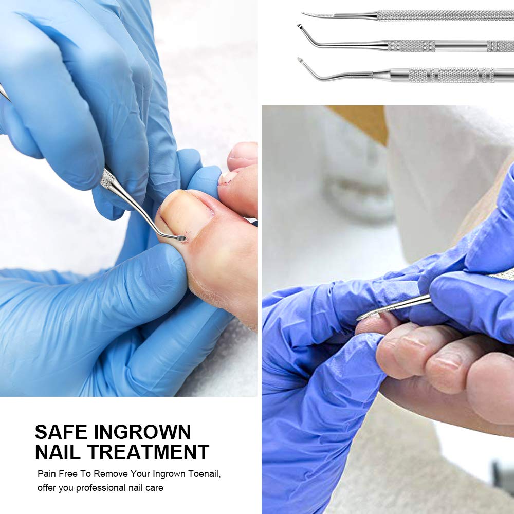 Teenitor Pedicure Tools for Feet, Toenail File and Lifters, Upgraded Professional Surgical Safe