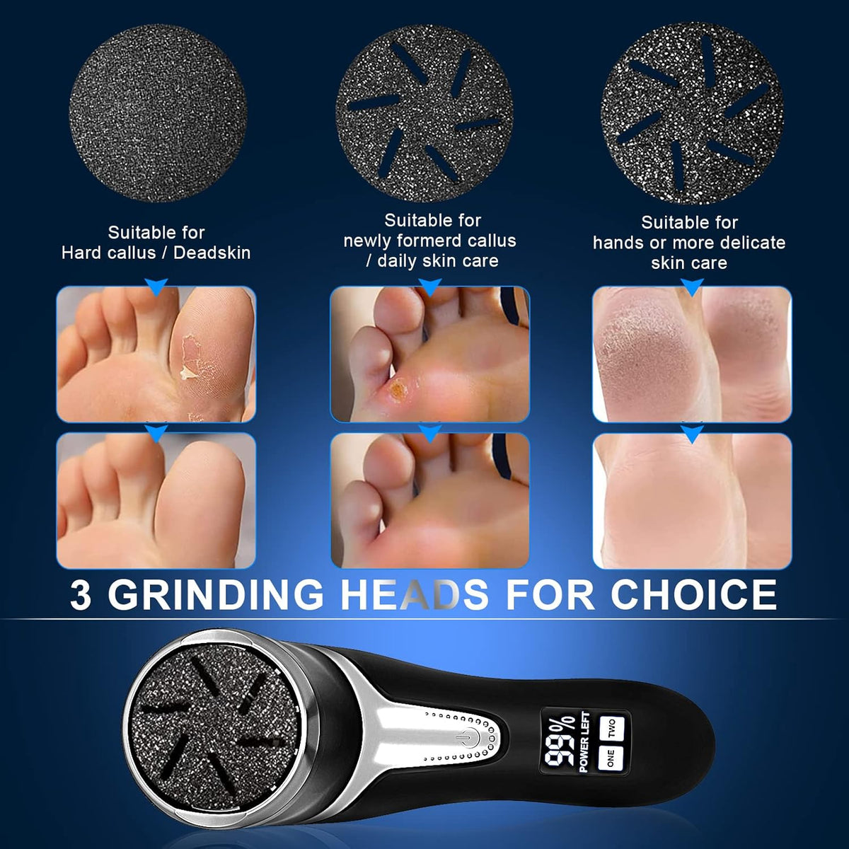 Electric Callus Remover for Feet with Vacuum, Professional Pedicure Tools Kit, Rechargeable