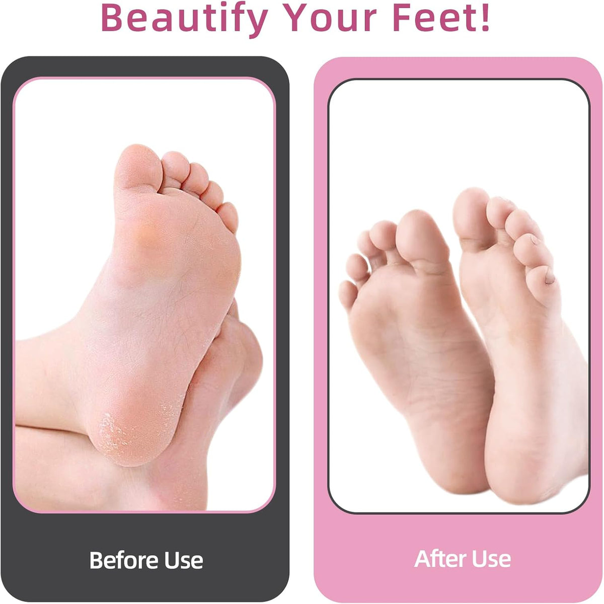 4.8IN Longer Electric Foot Callus Remover with 80pcs Sandpaper Discs, Professional Aluminum Callus