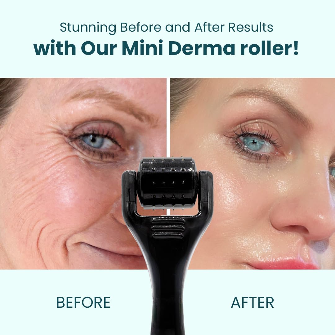 Gin Amber Beauty Mini Derma roller (0.25mm) - 48 Real Individual Needles, Microdermabrasion Device