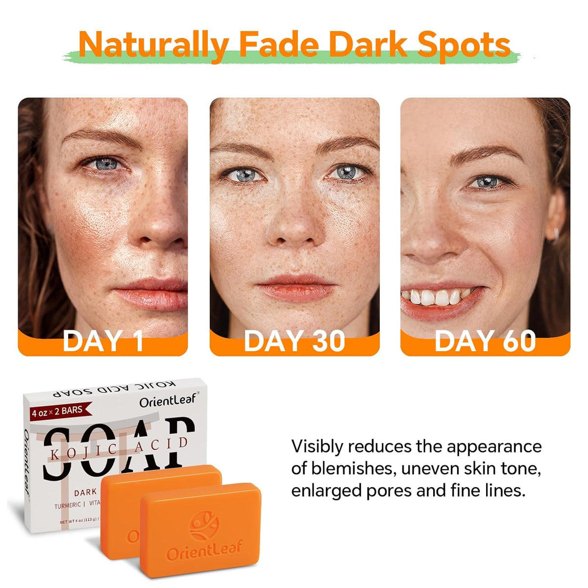 Kojic Acid and Turmeric Soap for Dark Spots Remover, Brightening, Hyperpigmentation for Face, 4oz x