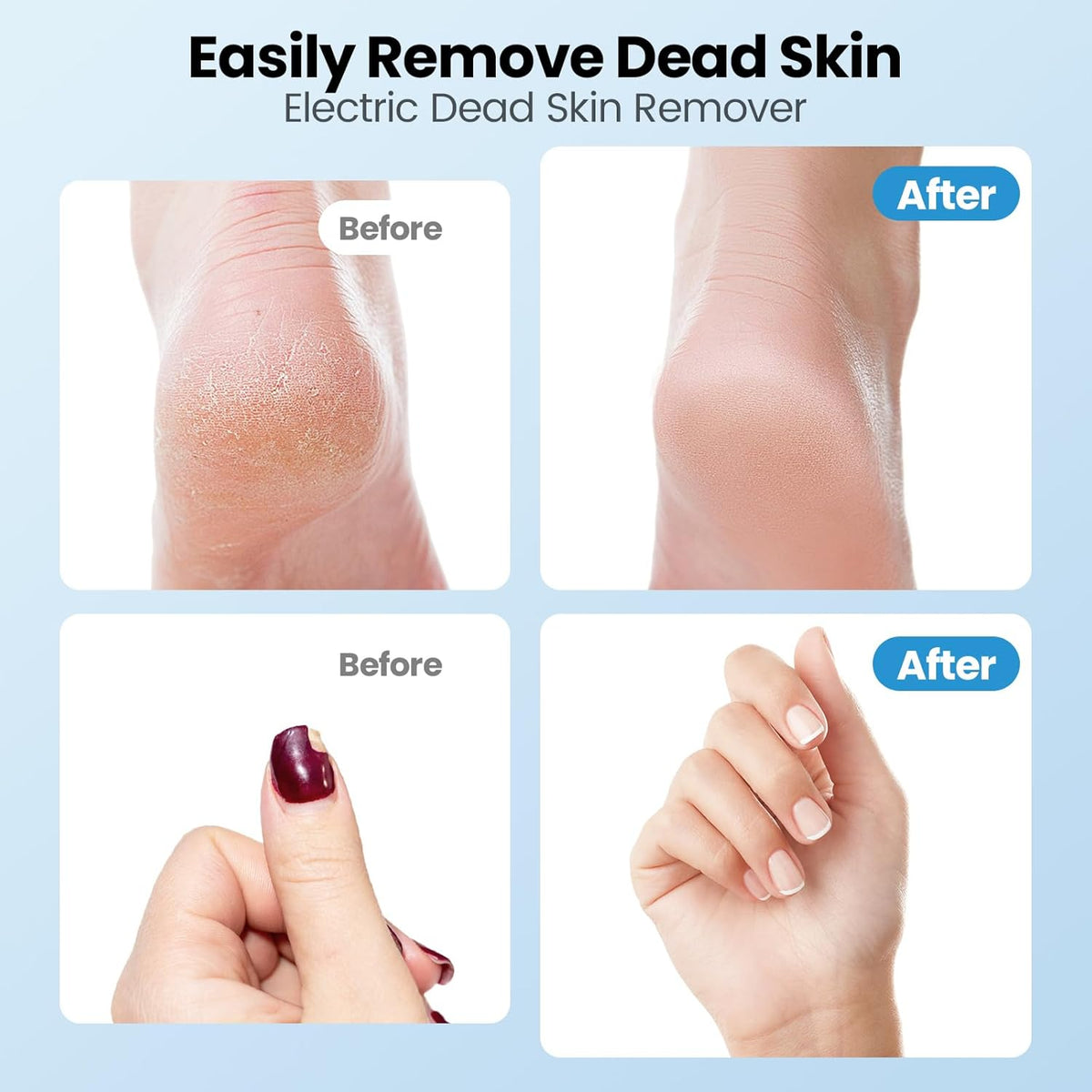 Electric Callus Remover for Feet, 2 in 1 Electric Foot File Grinder, Rechargeable Cordless Foot