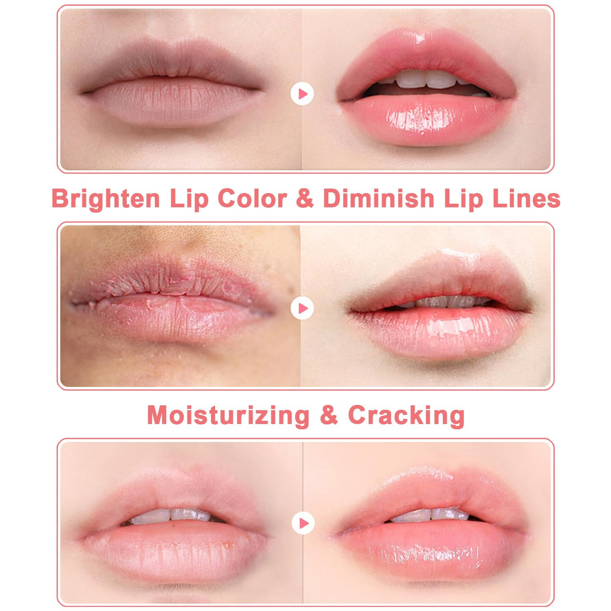 3 PCS Bee Lip Balm Mask Honey Pot, Watermelon, Cherry & Coconut Propolis Moisturizing, Hydrating