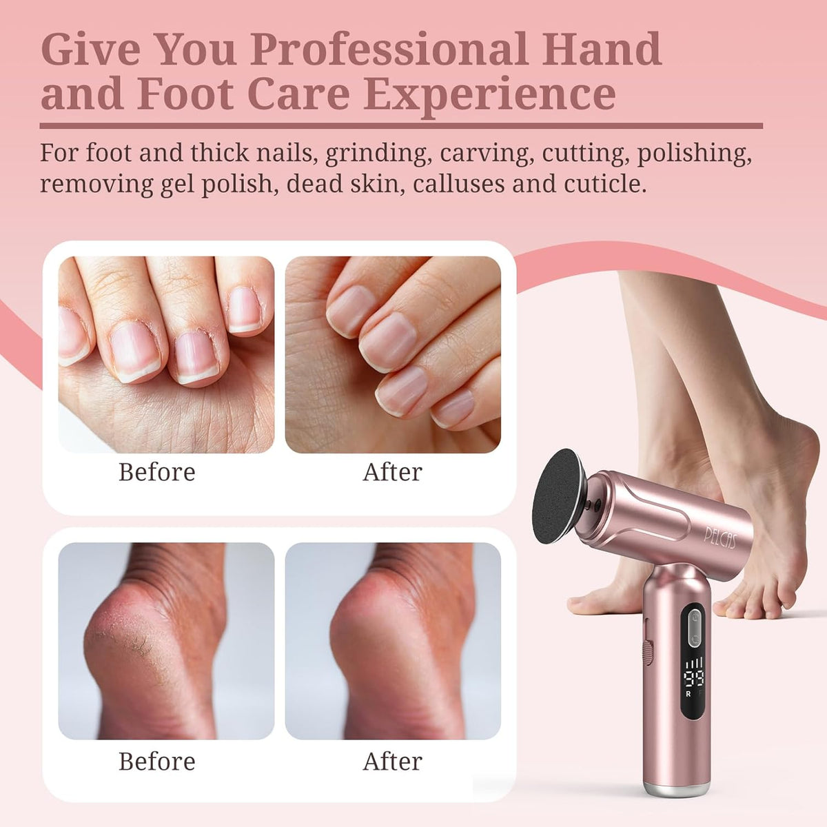 PELCAS Electric Foot Callus Remover with LED Screen, 2 in 1 Manicure & Pedicure Kit, Upgraded