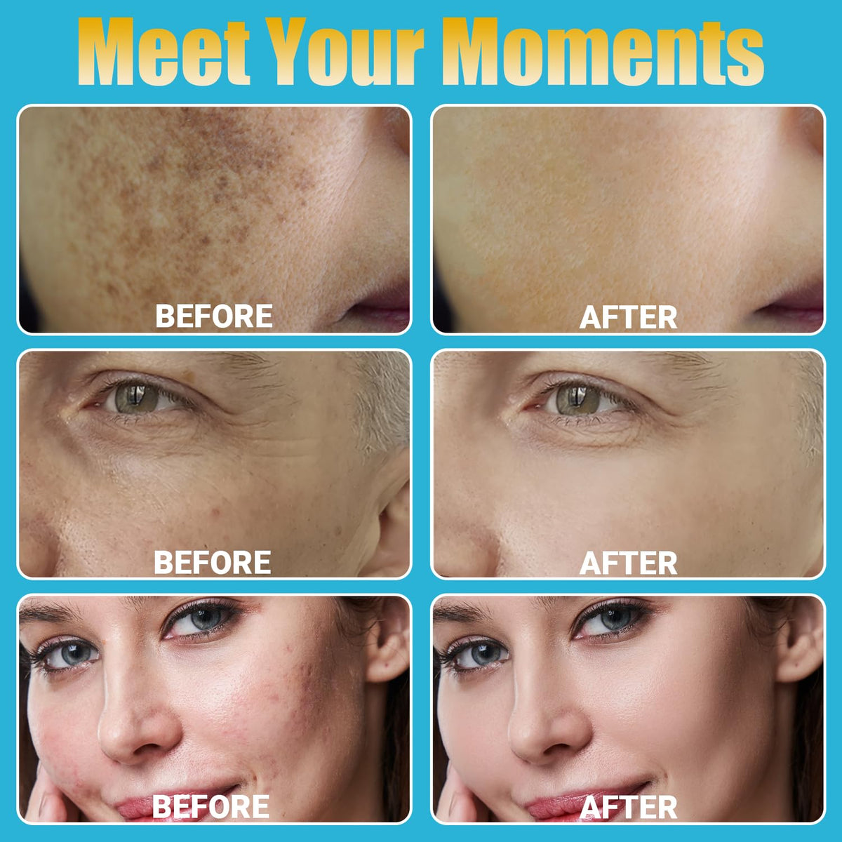 Home Use Microneedling Microneedle Skin Care Beauty Kit Tool for Face Hair Beard