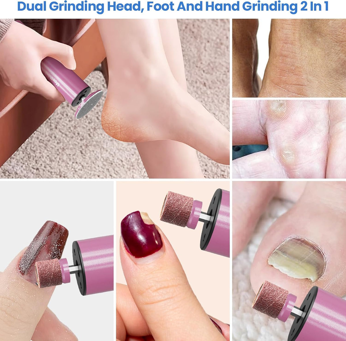 Electric Foot Callus Remover, 2 in 1 | 6 Speed Adjustable Foot File Nail Grinder with Sandpaper