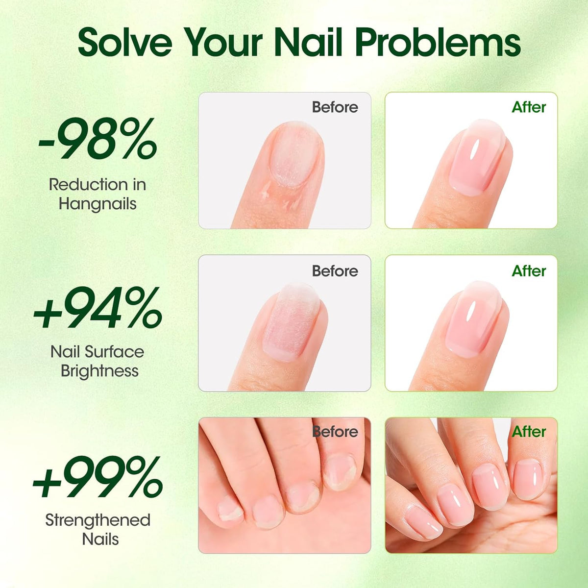 Gellen Cuticle Oil, Roll-On Nail Growth Oil, Nail Oil for Nail Growth & Repair & Strength, Green
