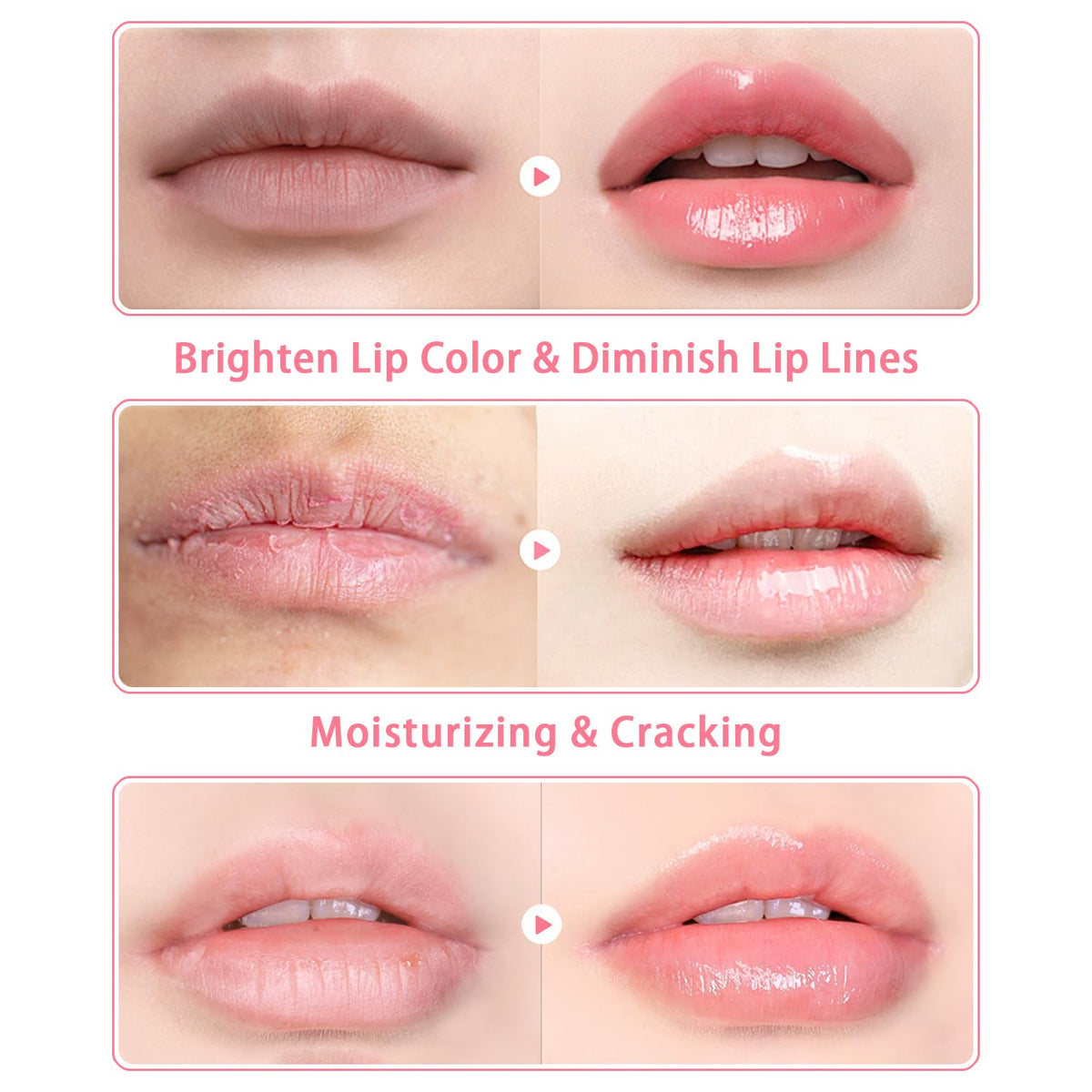 3 PCS Bee Lip Balm Lip Mask Honey Pot, Watermelon & Cherry & Coconut Lip Mask Propolis Moisturizing