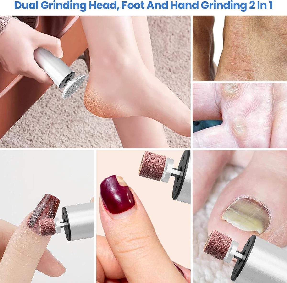 Electric Foot Callus Remover, 2 in 1 | 6 Speed Adjustable Foot File Nail Grinder with Sandpaper