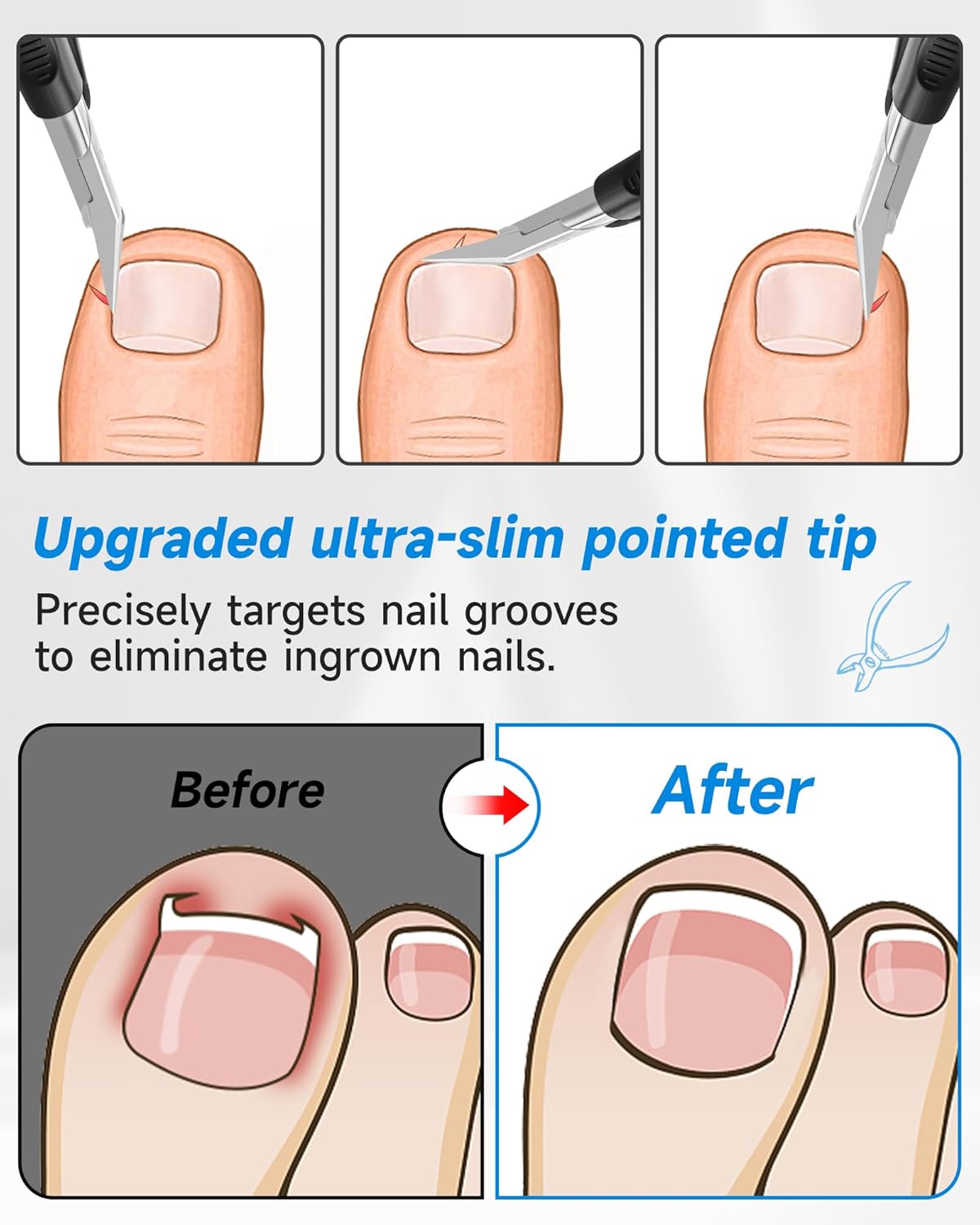 Nail Clippers,Toenail Clipper for Ingrown or Thick Toe Nails,Fingernail Clipper for Men Women