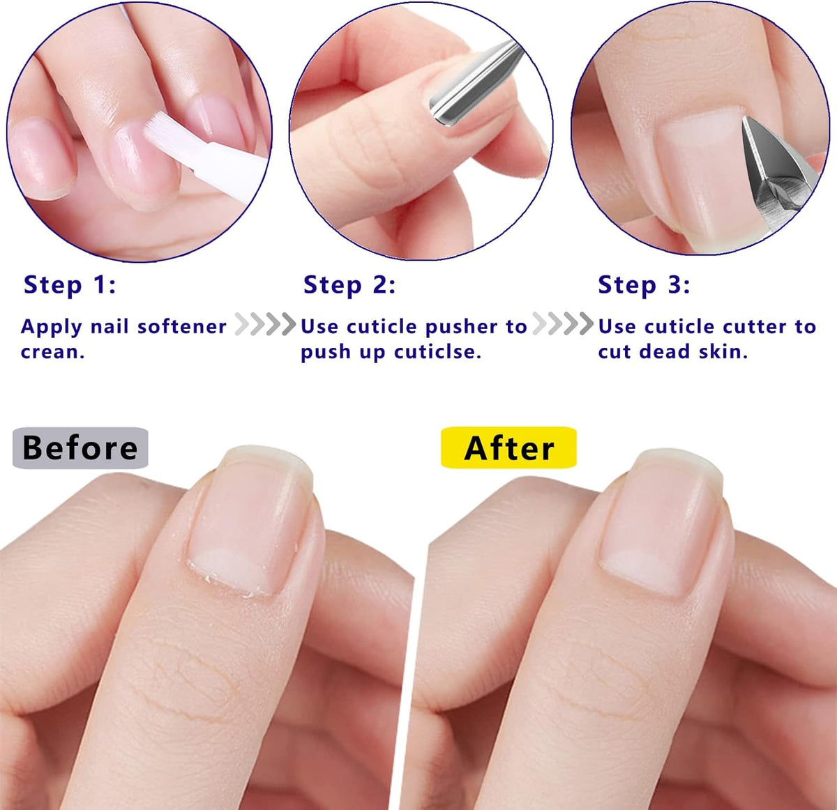Cuticle Trimmer Cuticle Remover with Cuticle Pusher, XUNXMAS Professional Stainless Steel Durable