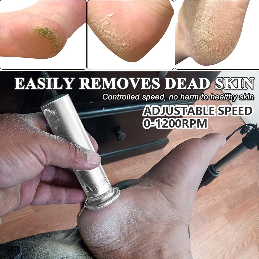 Upgraded Electric Callus Remover for Feet 1200rpm, Adjustable Speed Professional Electric Foot File