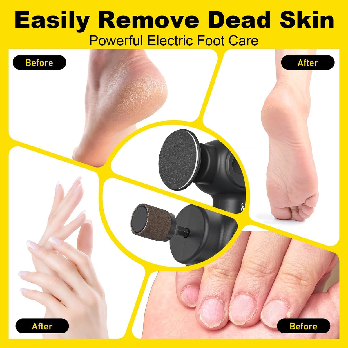 Electric Foot Callus Remover Rechargeable, Electronic Foot File Pedicure Tool, 2 in 1 Foot Grinder