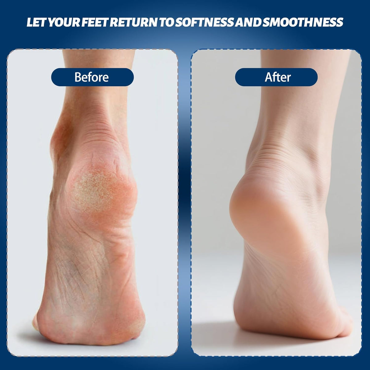 Electric Feet Foot Callus Remover Equipped with A Vacuum System Foot Scrubber 17 in 1 Professional