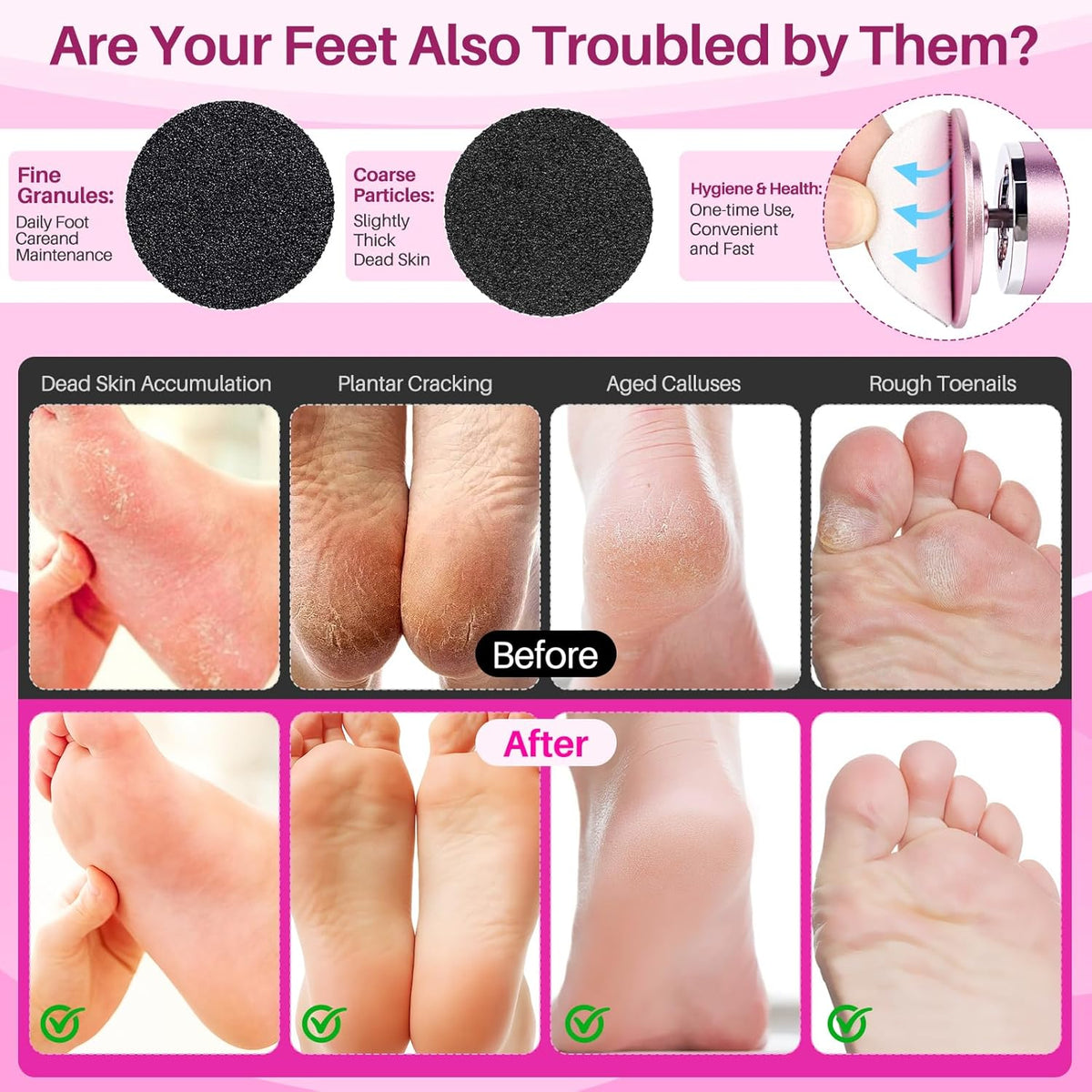 LIONVISON Electric Foot Callus Remover: Adjustable Speed Foot File for Cracked Heels - Working
